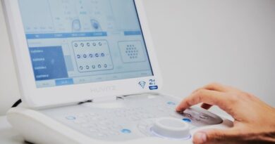 Novos equipamentos chegam a UBS’s e secretarias municipais devem formalizar recebimento